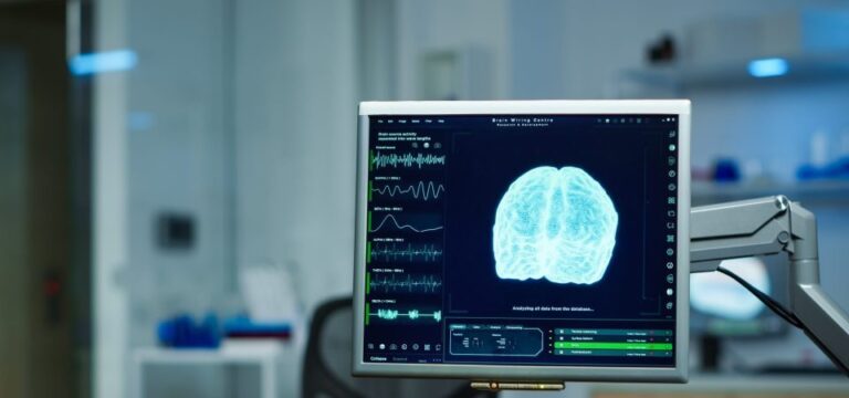 Cerebro: Nuevos hallazgos sobre esquizofrenia y asimetría