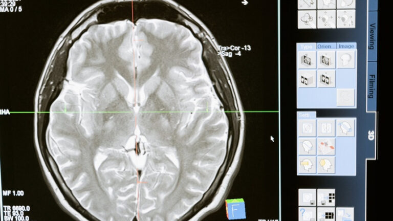 Cerebro reptiliano humano: Qué es ser una persona reptiliana