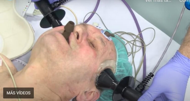 Cuáles son los síntomas de descargas eléctricas en el cerebro