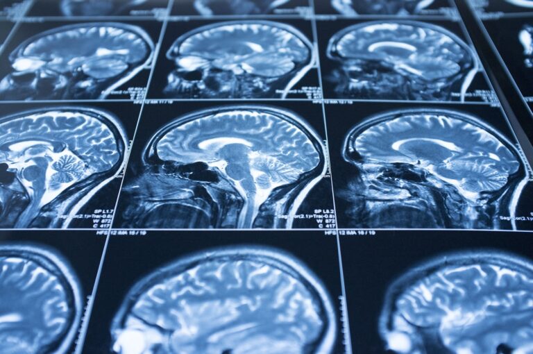 ¿Es legítima la hipnosis? Explorando la ciencia detrás de la hipnosis