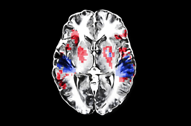 La música de los Beatles alivia el dolor y estimula el cerebro.