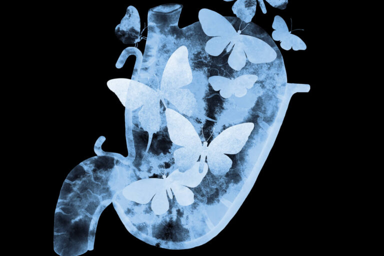 Mariposa dentro del estómago: Más que Nervios y Emociones