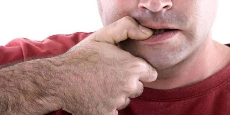 Onicofagia: Comprendiendo el hábito de morder las uñas