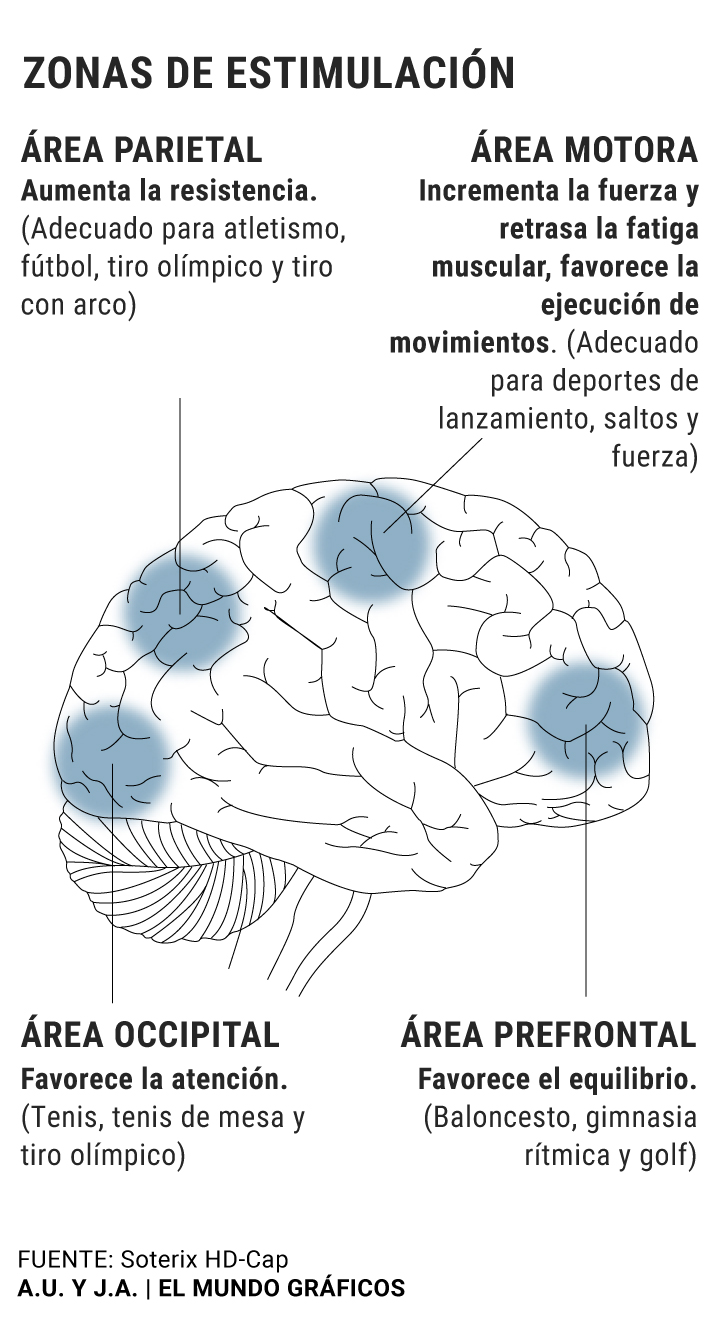 Qué beneficios y métodos tiene la estimulación del cerebro