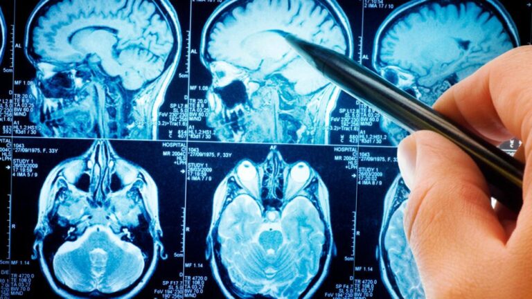 Qué factores pueden aumentar la inflamación cerebral.