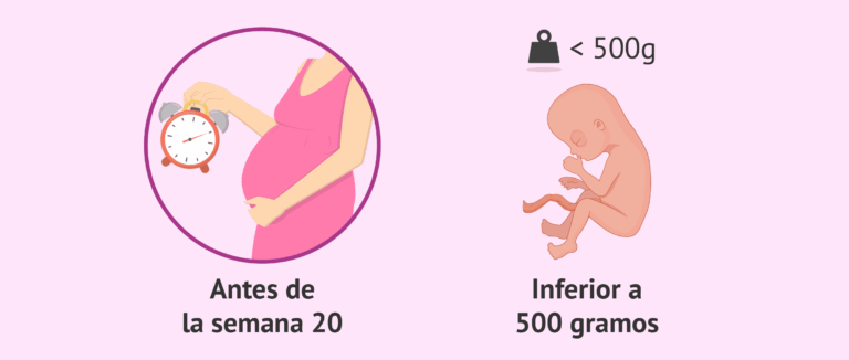 qué son los abortos espontáneos hasta la semana 20