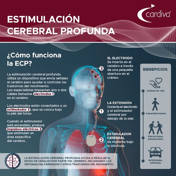 Qué tipos y beneficios tiene la estimulación cerebral