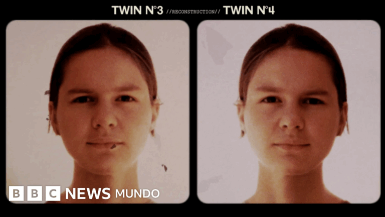 ¿Siguen vivos los Jim Twins? Explorando las vidas y los vínculos de los gemelos